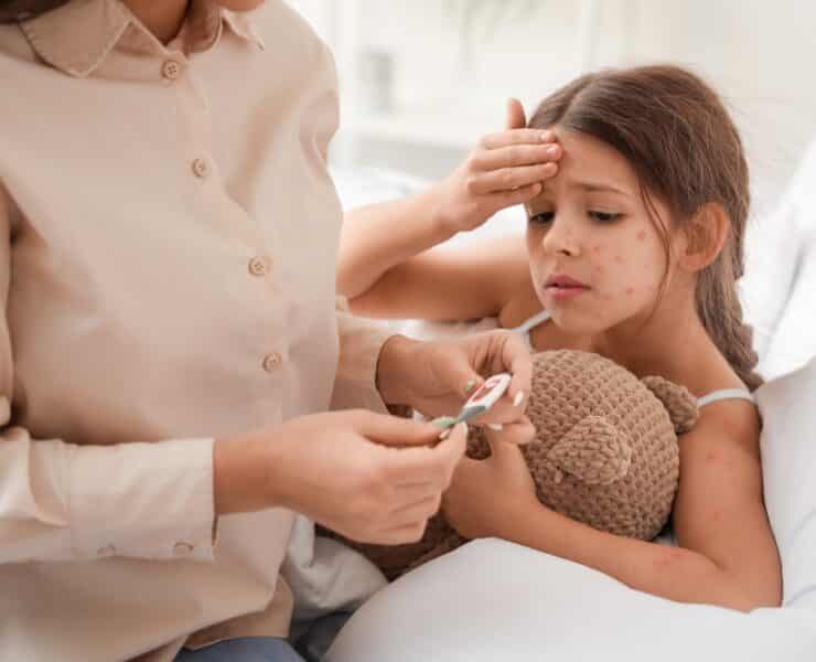kid with chickenpox in bed with a high temperature