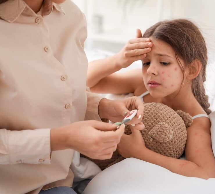 kid with chickenpox in bed with a high temperature
